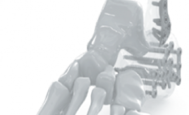 Chấn thương bàn chân và gót chân